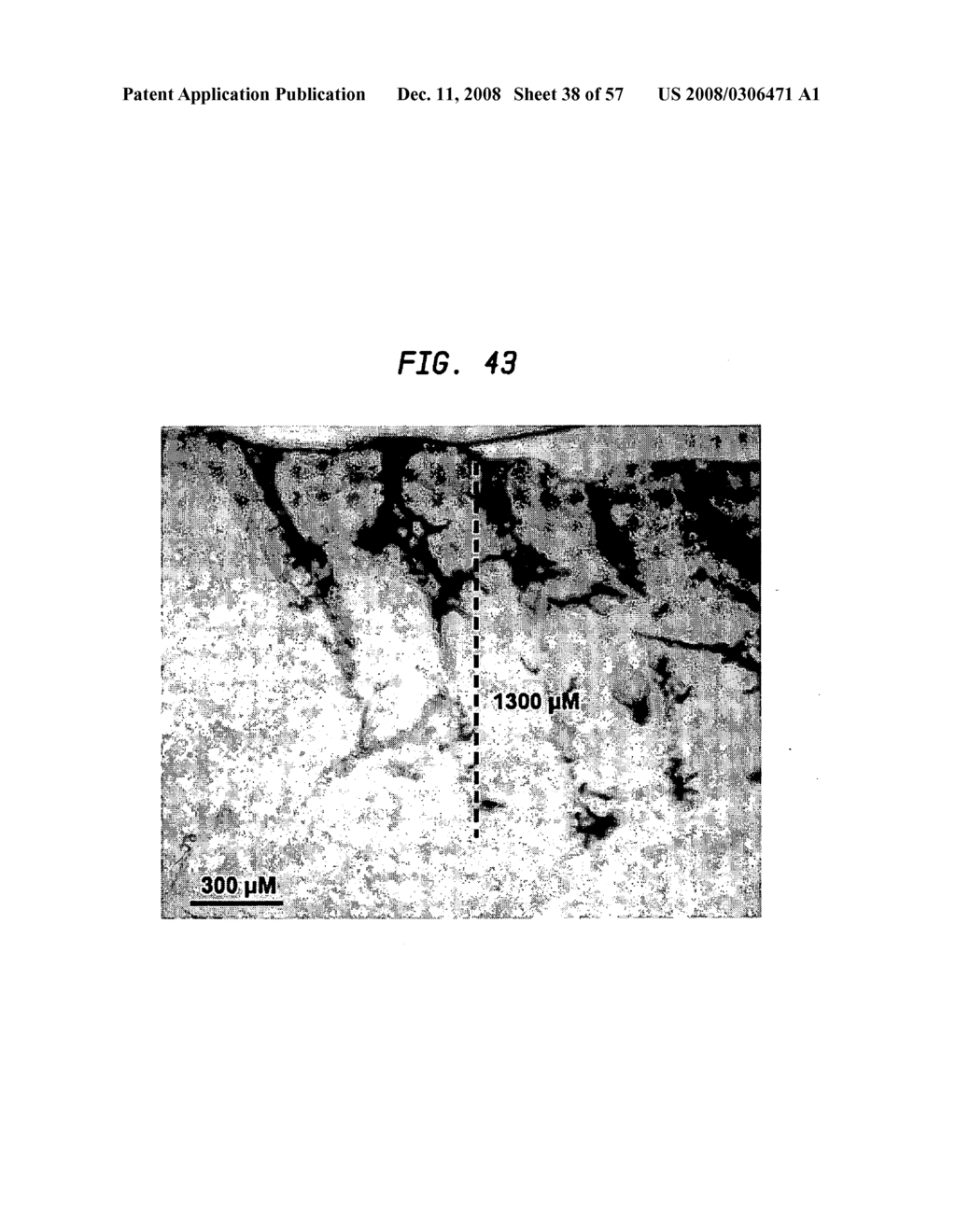 Methods and devices for fractional ablation of tissue - diagram, schematic, and image 39