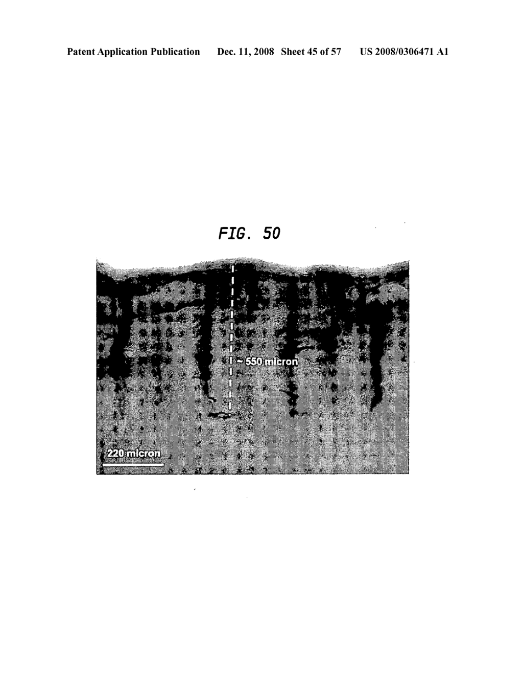 Methods and devices for fractional ablation of tissue - diagram, schematic, and image 46