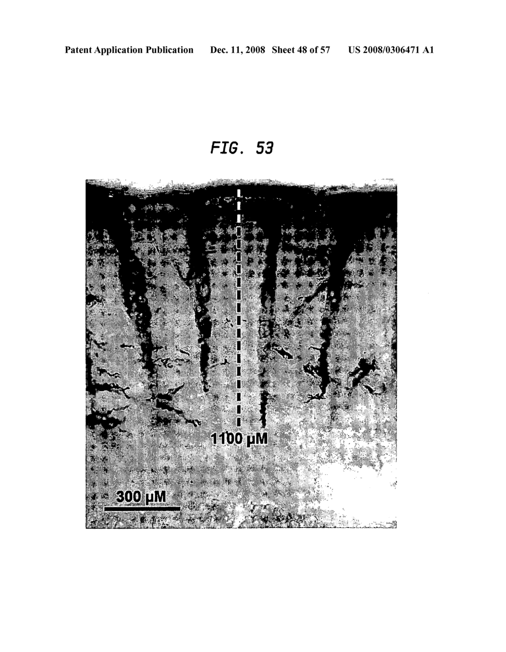 Methods and devices for fractional ablation of tissue - diagram, schematic, and image 49