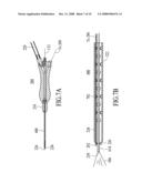 THERMALLY MEDIATED TISSUE MOLDING diagram and image