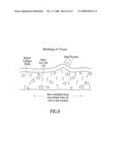 THERMALLY MEDIATED TISSUE MOLDING diagram and image