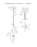 ATRIAL ABLATION CATHETER AND METHOD OF USE diagram and image