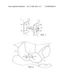 Scapho-lunate Fixation Implants and Methods of Use diagram and image