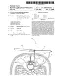 SYSTEM AND METHOD FOR PROVIDING SURGICAL ACCESS TO A SPINE diagram and image