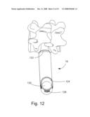 SYSTEM AND METHOD FOR PROVIDING SURGICAL ACCESS TO A SPINE diagram and image