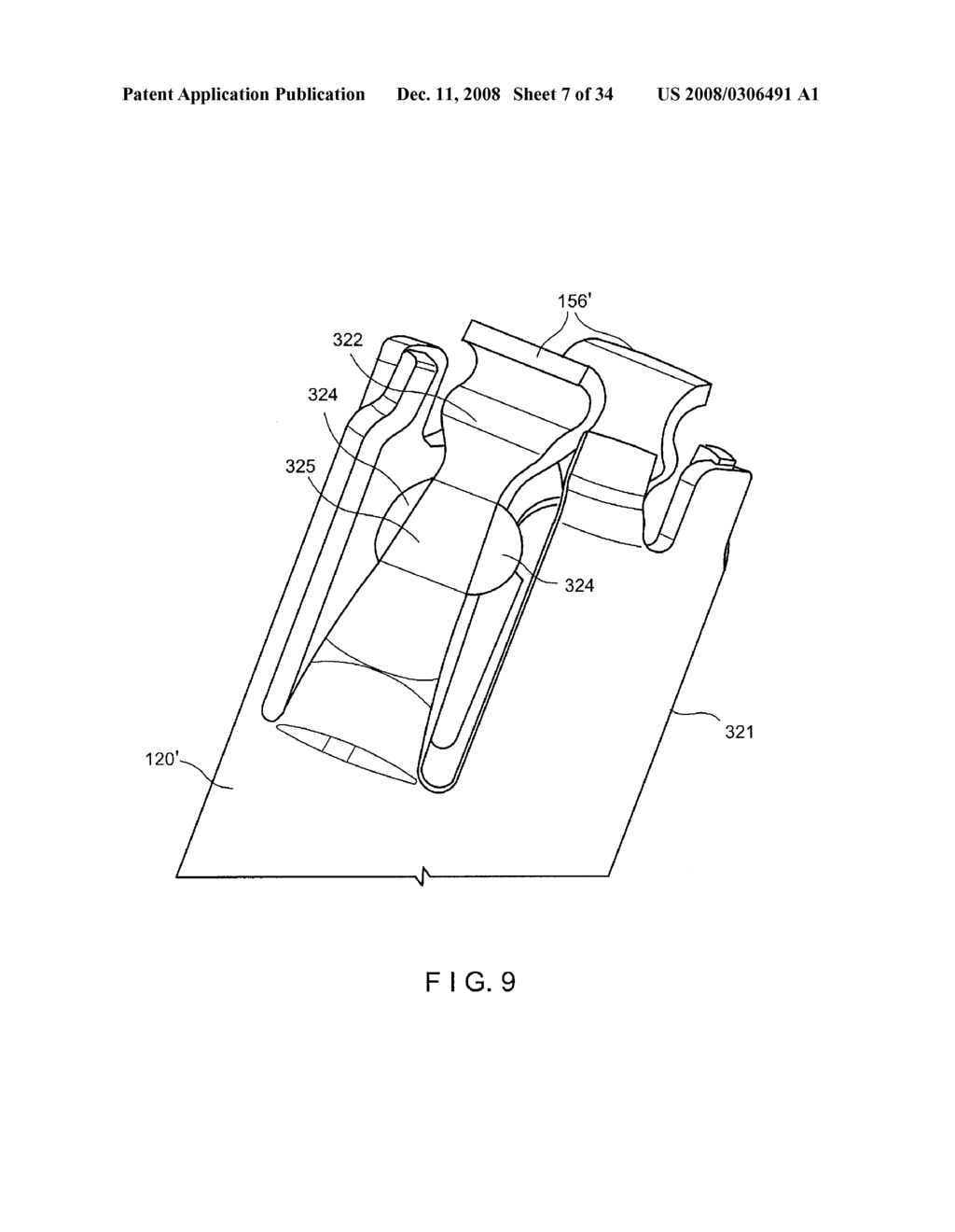 SINGLE STAGE HEMOSTASIS CLIPPING DEVICE - diagram, schematic, and image 08