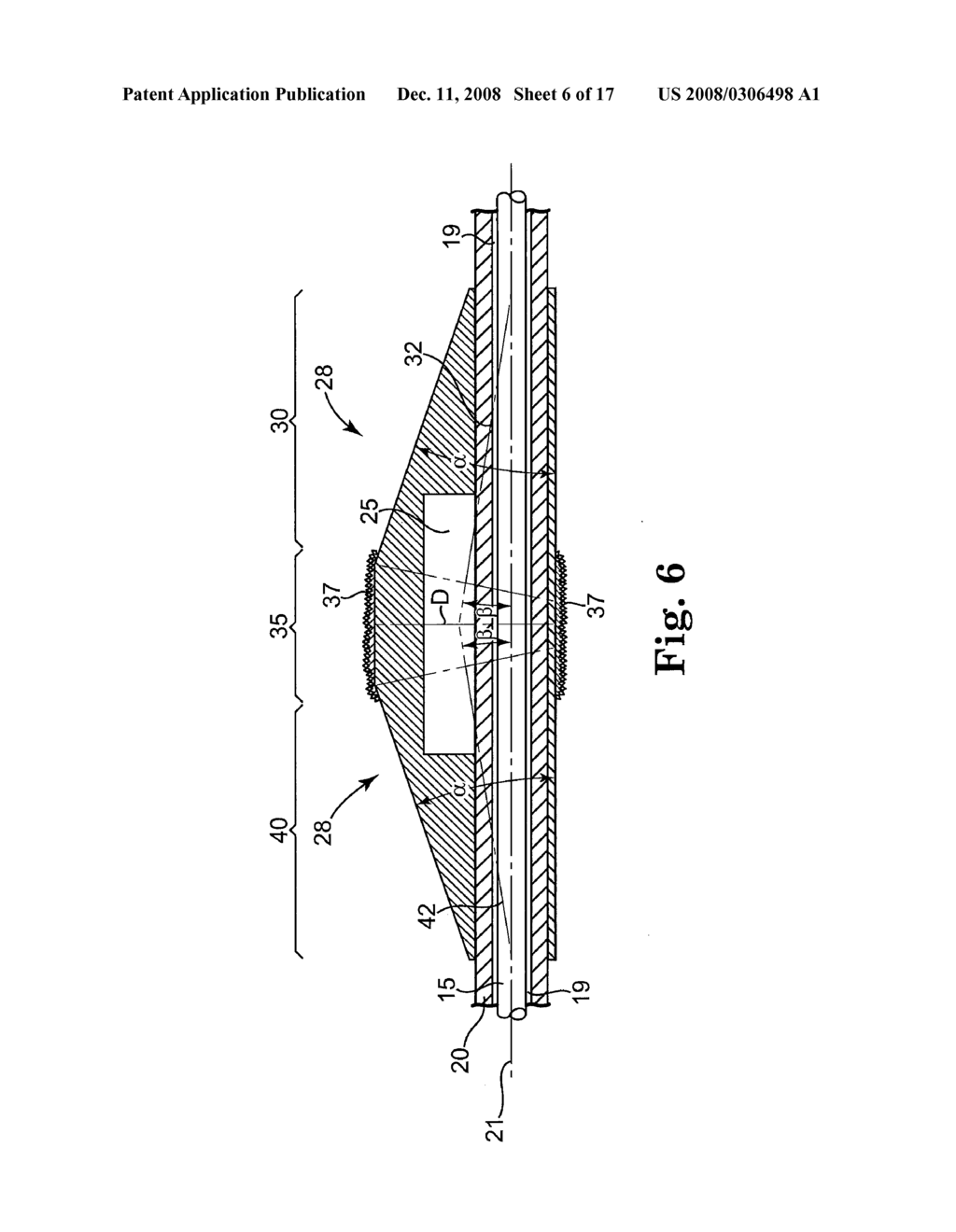 ECCENTRIC ABRADING HEAD FOR HIGH-SPEED ROTATIONAL ATHERECTOMY DEVICES - diagram, schematic, and image 07