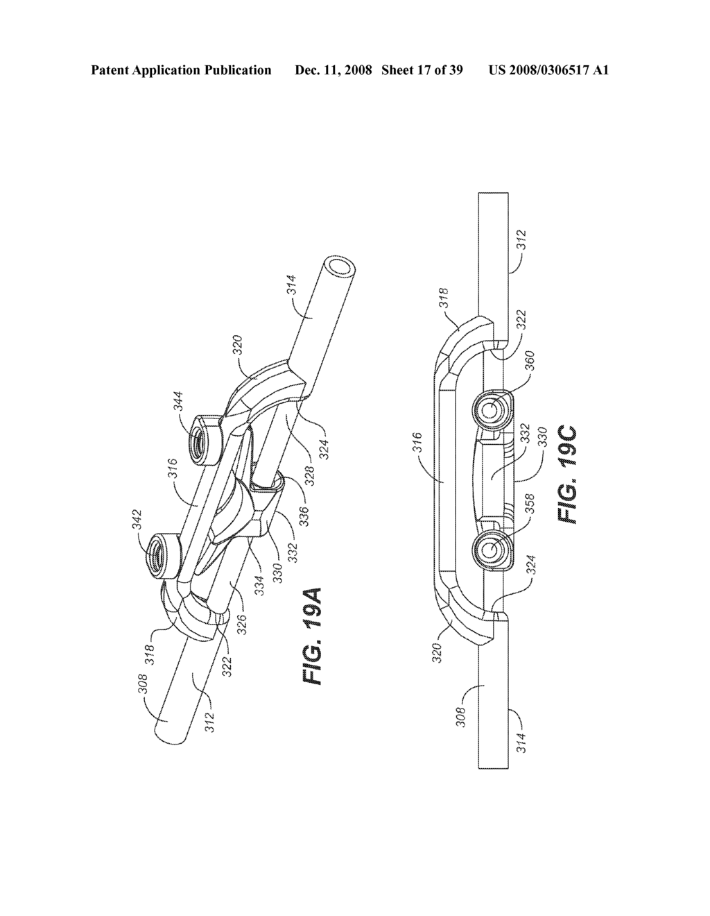 DYNAMIC STABILIZATION AND MOTION PRESERVATION SPINAL IMPLANTATION SYSTEM AND METHOD WITH A DEFLECTION ROD MOUNTED IN CLOSE PROXIMITY TO A MOUNTING ROD - diagram, schematic, and image 18