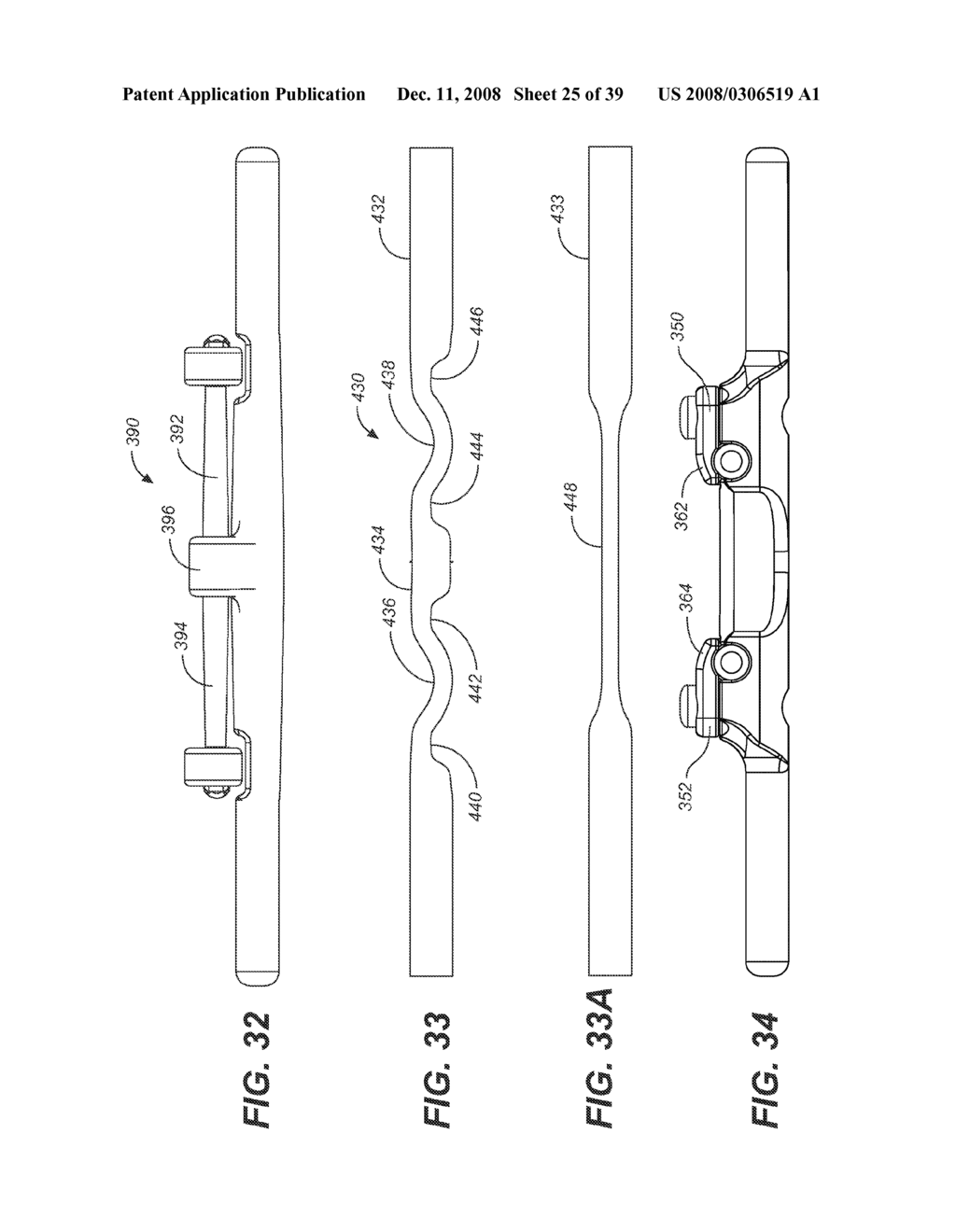 REVISION SYSTEM AND METHOD FOR A DYNAMIC STABILIZATION AND MOTION PRESERVATION SPINAL IMPLANTATION SYSTEM AND METHOD - diagram, schematic, and image 26