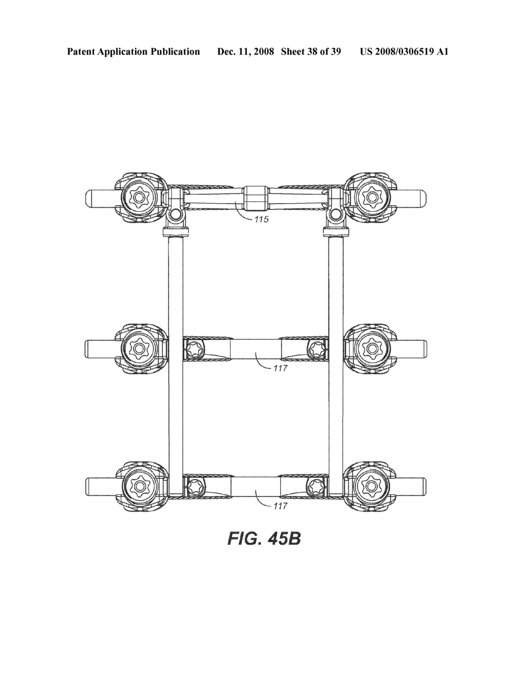 REVISION SYSTEM AND METHOD FOR A DYNAMIC STABILIZATION AND MOTION PRESERVATION SPINAL IMPLANTATION SYSTEM AND METHOD - diagram, schematic, and image 39