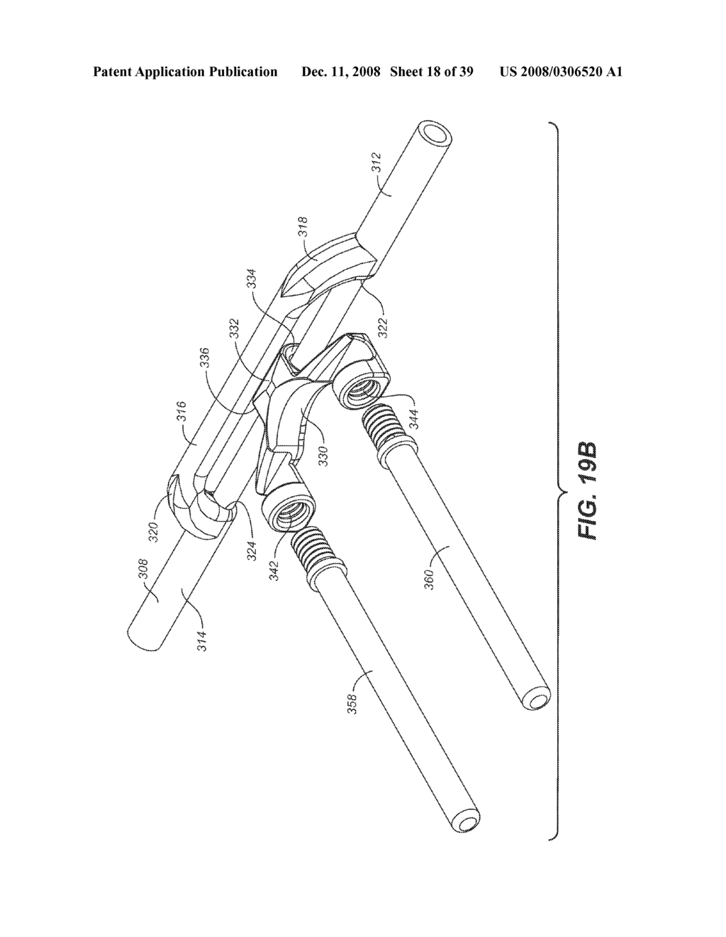 IMPLANTATION METHOD FOR A DYNAMIC STABILIZATION AND MOTION PRESERVATION SPINAL IMPLANTATION SYSTEM AND METHOD - diagram, schematic, and image 19