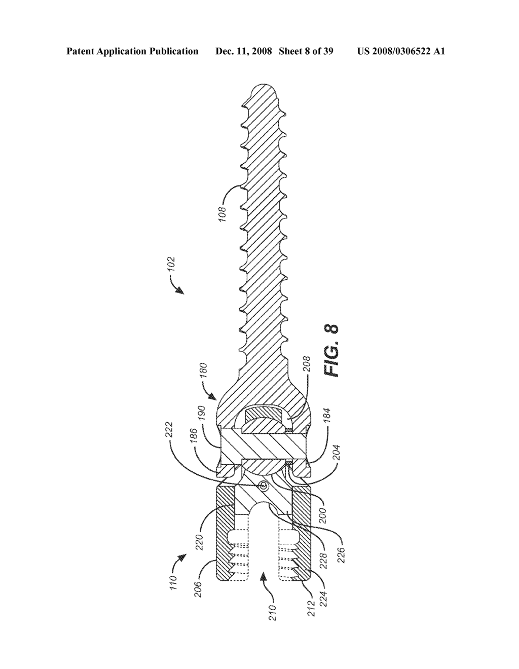 HORIZONTALLY LOADED DYNAMIC STABILIZATION AND MOTION PRESERVATION SPINAL IMPLANTATION SYSTEM AND METHOD - diagram, schematic, and image 09