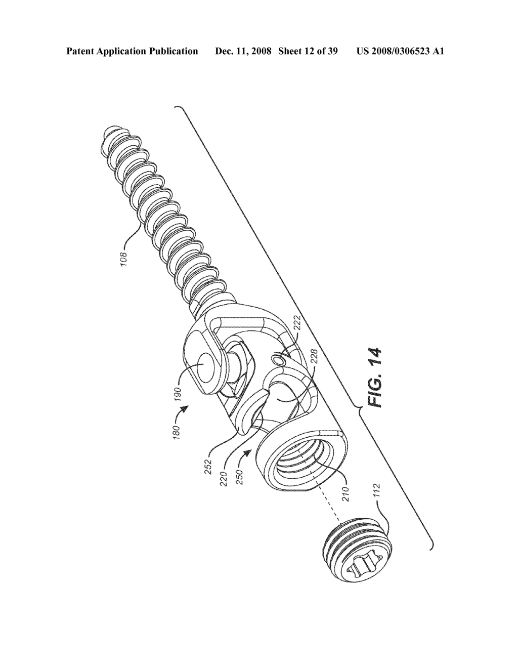 DYNAMIC STABILIZATION AND MOTION PRESERVATION SPINAL IMPLANTATION SYSTEM WITH HORIZONTAL DEFLECTION ROD AND ARTICULATING VERTICAL RODS - diagram, schematic, and image 13