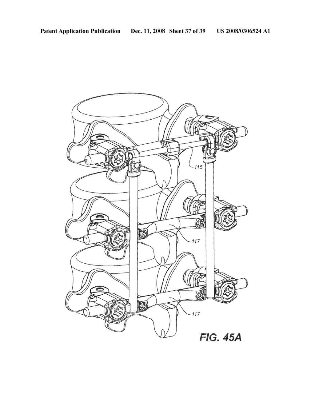 ANCHOR SYSTEM FOR A SPINE IMPLANTATION SYSTEM THAT CAN MOVE ABOUT THREE AXES - diagram, schematic, and image 38