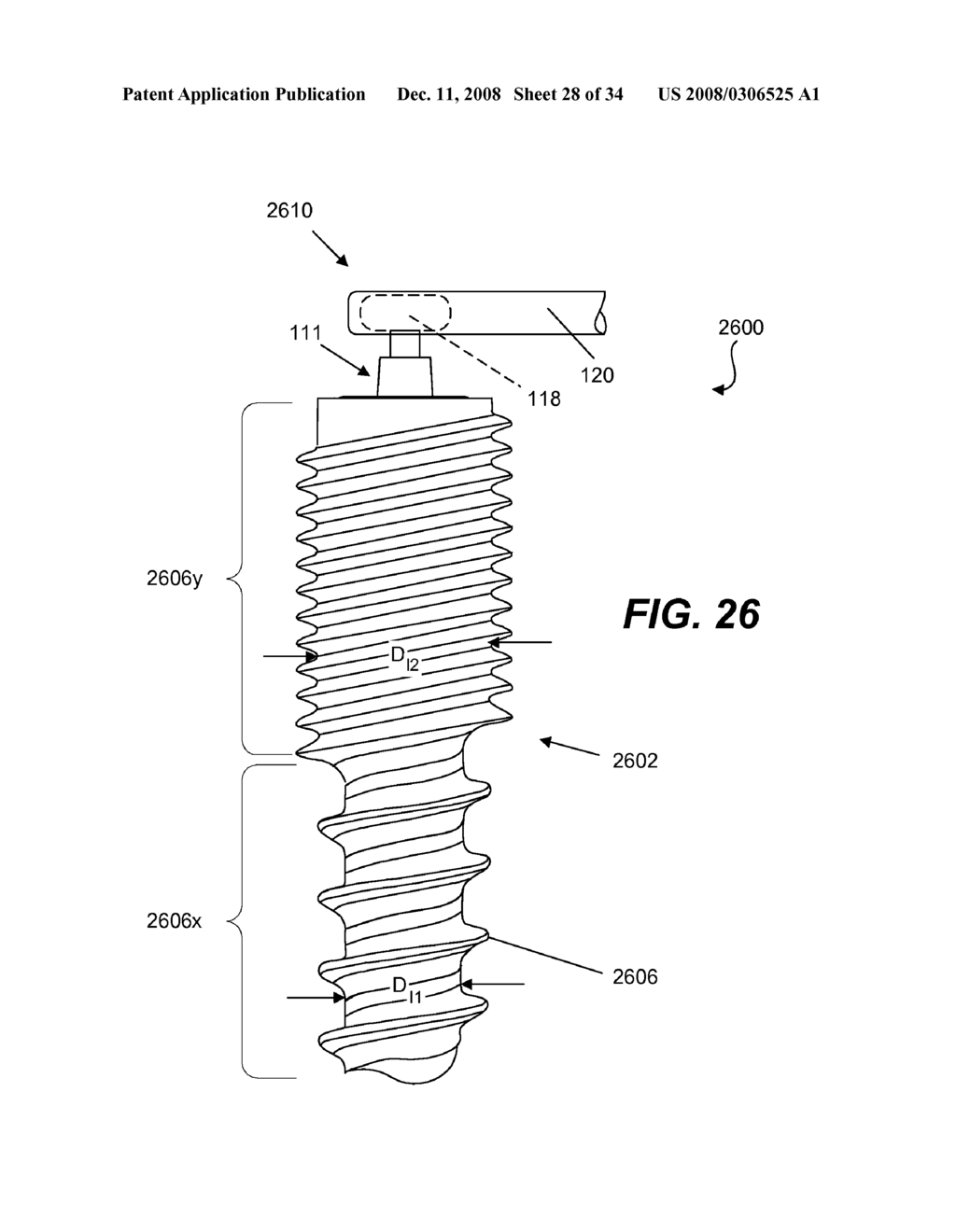 SPINE IMPLANT WITH A DEFLECTION ROD SYSTEM INCLUDING A DEFLECTION LIMITING SHIELD ASSOCIATED WITH A BONE SCREW AND METHOD - diagram, schematic, and image 29