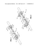 DEFLECTION ROD SYSTEM WITH A DEFLECTION CONTOURING SHIELD FOR A SPINE IMPLANT AND METHOD diagram and image