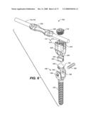 DEFLECTION ROD SYSTEM WITH A DEFLECTION CONTOURING SHIELD FOR A SPINE IMPLANT AND METHOD diagram and image