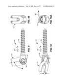 DEFLECTION ROD SYSTEM WITH A DEFLECTION CONTOURING SHIELD FOR A SPINE IMPLANT AND METHOD diagram and image