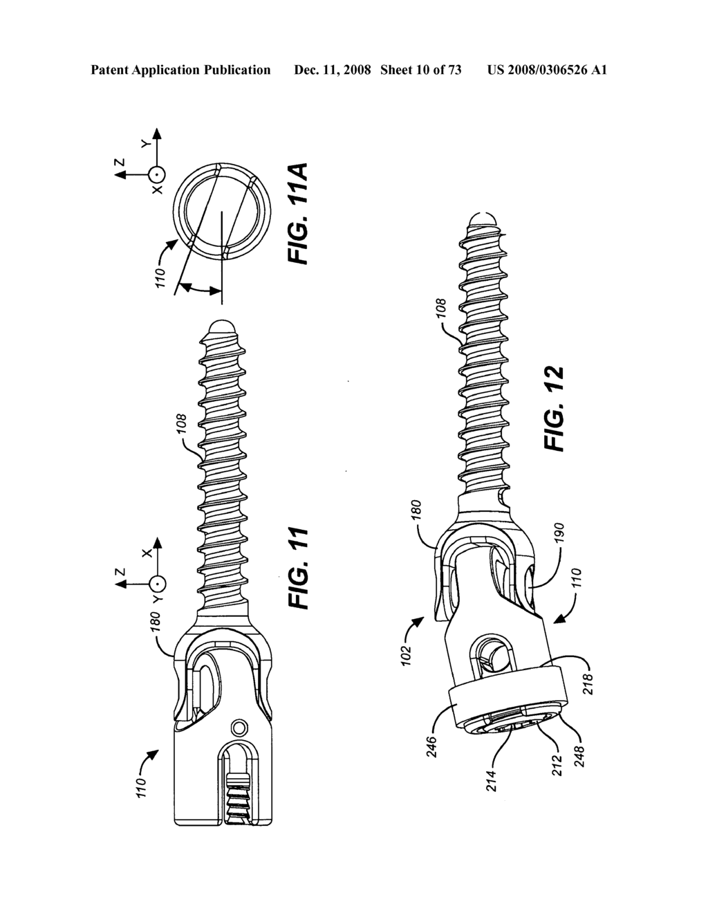 DEFLECTION ROD SYSTEM WITH A DEFLECTION CONTOURING SHIELD FOR A SPINE IMPLANT AND METHOD - diagram, schematic, and image 11