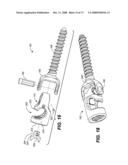 DEFLECTION ROD SYSTEM WITH A DEFLECTION CONTOURING SHIELD FOR A SPINE IMPLANT AND METHOD diagram and image