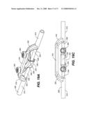 DEFLECTION ROD SYSTEM WITH A DEFLECTION CONTOURING SHIELD FOR A SPINE IMPLANT AND METHOD diagram and image