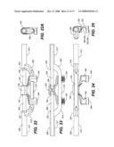 DEFLECTION ROD SYSTEM WITH A DEFLECTION CONTOURING SHIELD FOR A SPINE IMPLANT AND METHOD diagram and image