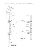 DEFLECTION ROD SYSTEM WITH A DEFLECTION CONTOURING SHIELD FOR A SPINE IMPLANT AND METHOD diagram and image