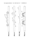 DEFLECTION ROD SYSTEM WITH A DEFLECTION CONTOURING SHIELD FOR A SPINE IMPLANT AND METHOD diagram and image