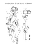 DEFLECTION ROD SYSTEM WITH A DEFLECTION CONTOURING SHIELD FOR A SPINE IMPLANT AND METHOD diagram and image