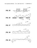 DEFLECTION ROD SYSTEM WITH A DEFLECTION CONTOURING SHIELD FOR A SPINE IMPLANT AND METHOD diagram and image