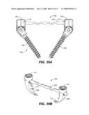 DEFLECTION ROD SYSTEM WITH A DEFLECTION CONTOURING SHIELD FOR A SPINE IMPLANT AND METHOD diagram and image