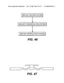 DEFLECTION ROD SYSTEM WITH A DEFLECTION CONTOURING SHIELD FOR A SPINE IMPLANT AND METHOD diagram and image