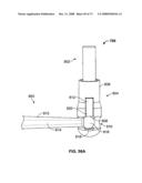 DEFLECTION ROD SYSTEM WITH A DEFLECTION CONTOURING SHIELD FOR A SPINE IMPLANT AND METHOD diagram and image