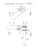 DEFLECTION ROD SYSTEM WITH A DEFLECTION CONTOURING SHIELD FOR A SPINE IMPLANT AND METHOD diagram and image