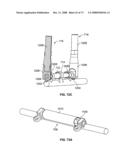 DEFLECTION ROD SYSTEM WITH A DEFLECTION CONTOURING SHIELD FOR A SPINE IMPLANT AND METHOD diagram and image