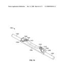 DEFLECTION ROD SYSTEM WITH A DEFLECTION CONTOURING SHIELD FOR A SPINE IMPLANT AND METHOD diagram and image