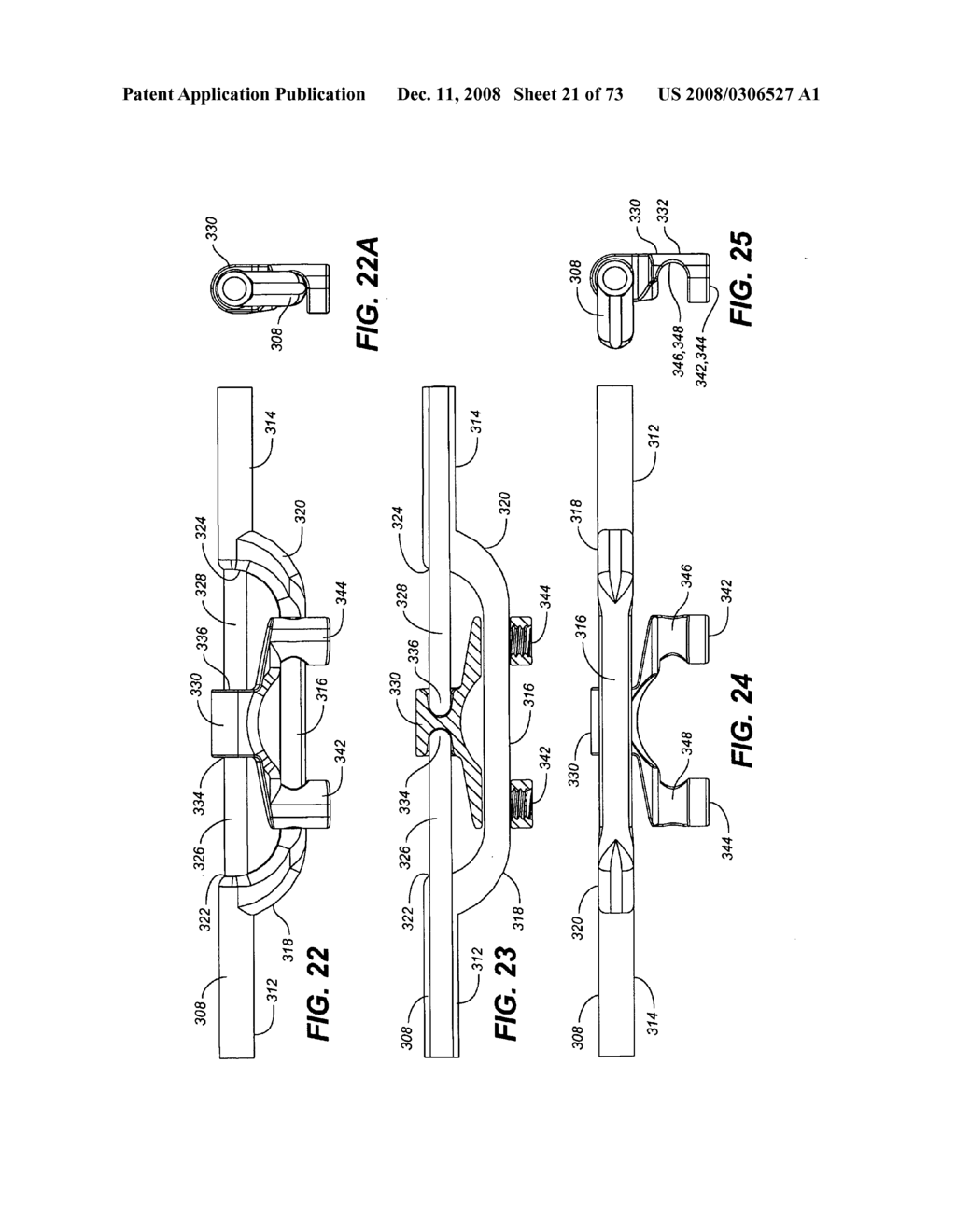 DYNAMIC STABILIZATION AND MOTION PRESERVATION SPINAL IMPLANTATION SYSTEM WITH A SHIELDED DEFLECTION ROD SYSTEM AND METHOD - diagram, schematic, and image 22