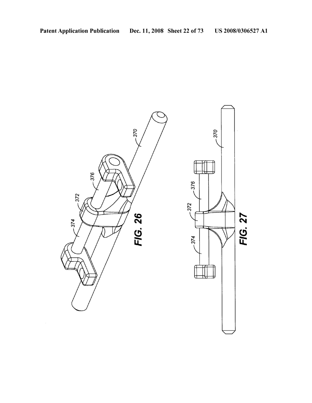 DYNAMIC STABILIZATION AND MOTION PRESERVATION SPINAL IMPLANTATION SYSTEM WITH A SHIELDED DEFLECTION ROD SYSTEM AND METHOD - diagram, schematic, and image 23