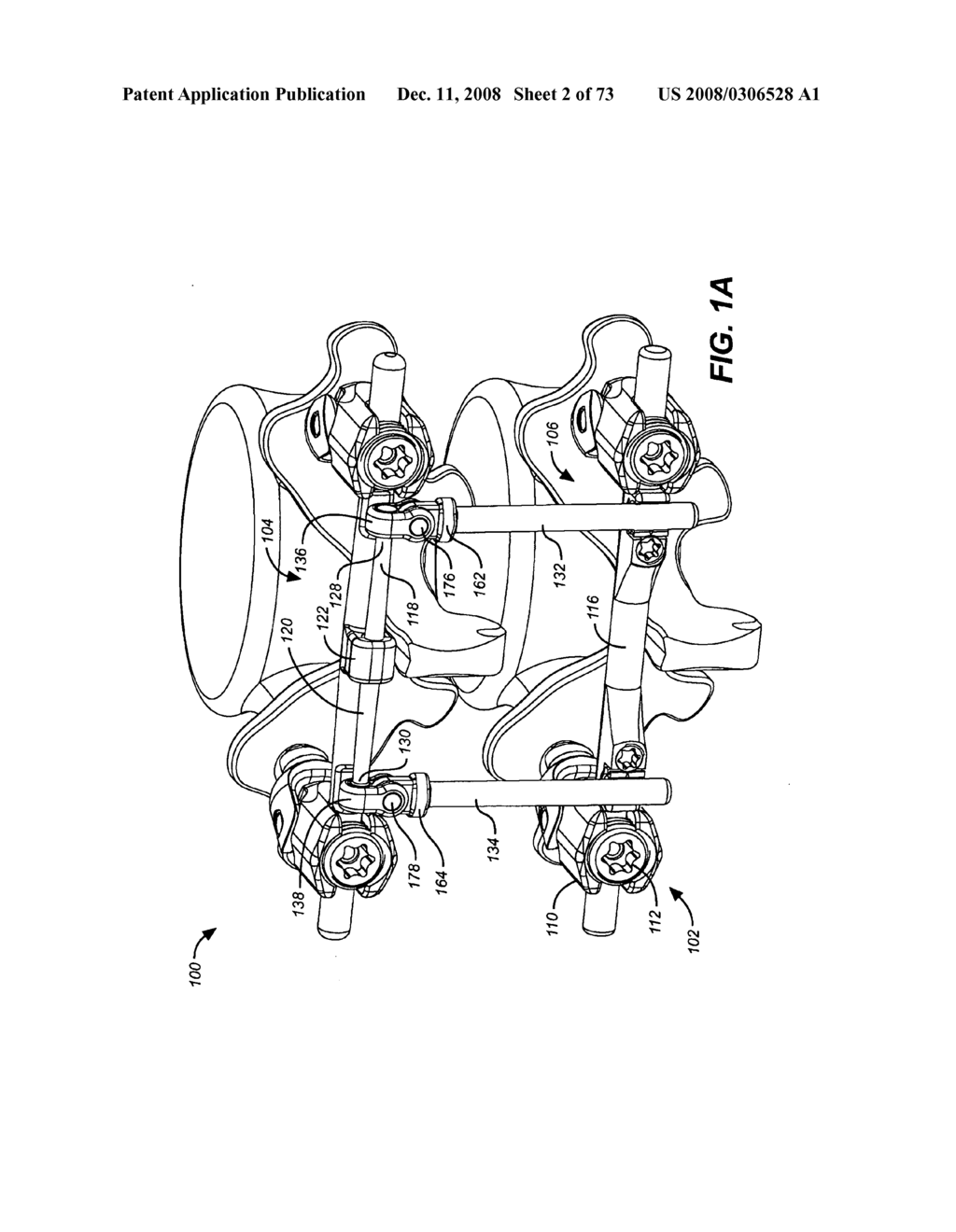 DEFLECTION ROD SYSTEM FOR SPINE IMPLANT WITH END CONNECTORS AND METHOD - diagram, schematic, and image 03