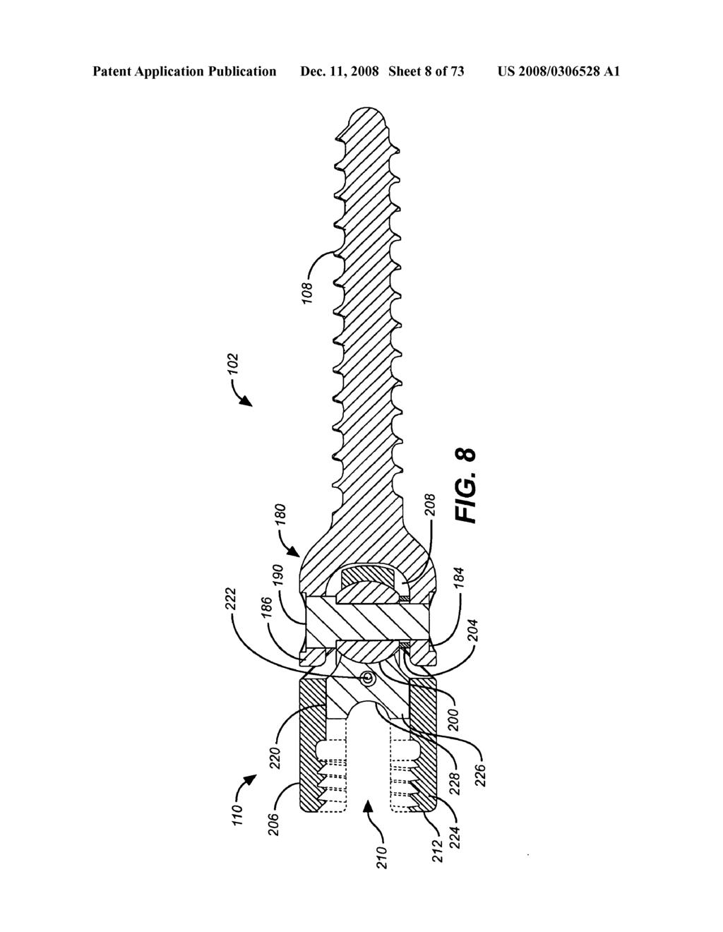 DEFLECTION ROD SYSTEM FOR SPINE IMPLANT WITH END CONNECTORS AND METHOD - diagram, schematic, and image 09