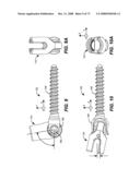 DEFLECTION ROD SYSTEM FOR SPINE IMPLANT WITH END CONNECTORS AND METHOD diagram and image