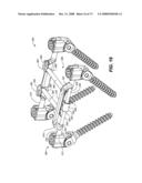 DEFLECTION ROD SYSTEM FOR SPINE IMPLANT WITH END CONNECTORS AND METHOD diagram and image