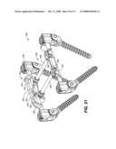 DEFLECTION ROD SYSTEM FOR SPINE IMPLANT WITH END CONNECTORS AND METHOD diagram and image