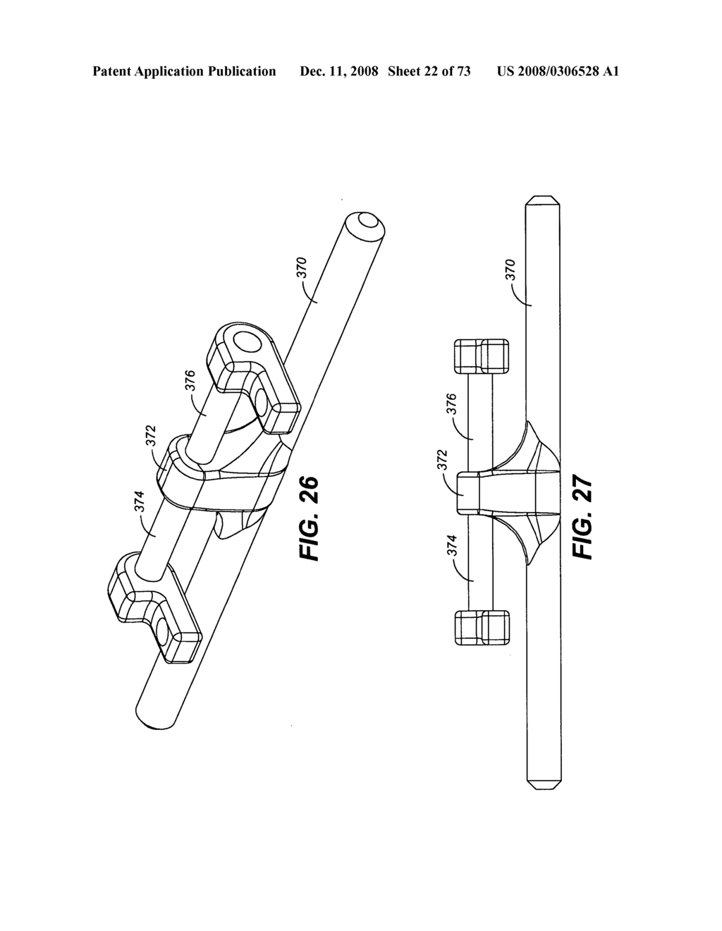 DEFLECTION ROD SYSTEM FOR SPINE IMPLANT WITH END CONNECTORS AND METHOD - diagram, schematic, and image 23