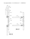 DEFLECTION ROD SYSTEM FOR SPINE IMPLANT WITH END CONNECTORS AND METHOD diagram and image