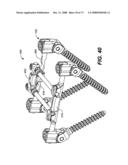 DEFLECTION ROD SYSTEM FOR SPINE IMPLANT WITH END CONNECTORS AND METHOD diagram and image