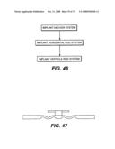 DEFLECTION ROD SYSTEM FOR SPINE IMPLANT WITH END CONNECTORS AND METHOD diagram and image