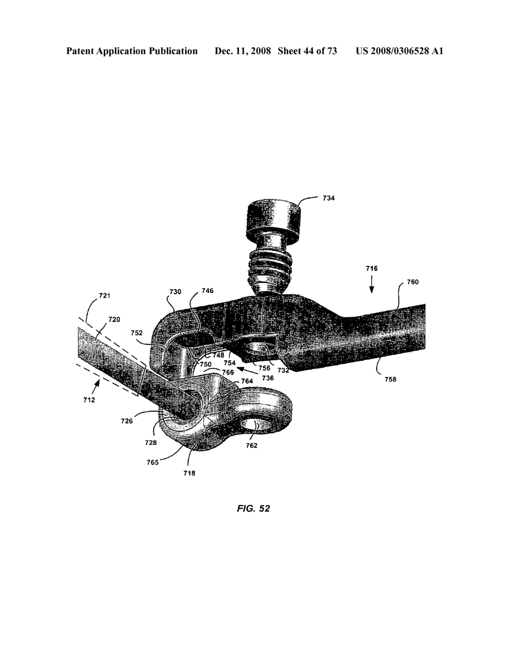 DEFLECTION ROD SYSTEM FOR SPINE IMPLANT WITH END CONNECTORS AND METHOD - diagram, schematic, and image 45