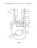 DEFLECTION ROD SYSTEM FOR SPINE IMPLANT WITH END CONNECTORS AND METHOD diagram and image