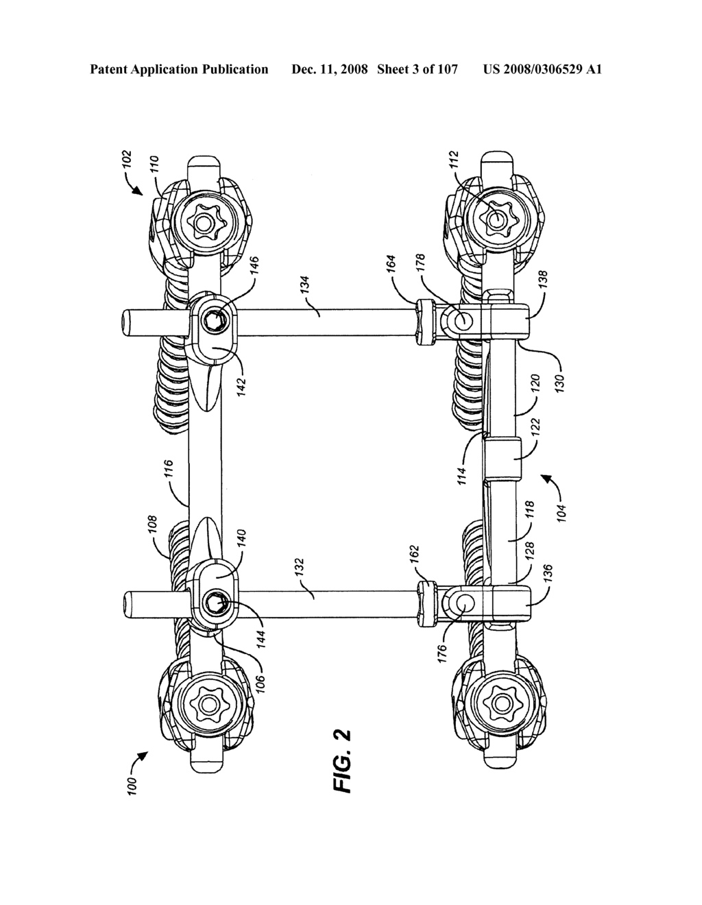 DEFLECTION ROD SYSTEM FOR A DYNAMIC STABILIZATION AND MOTION PRESERVATION SPINAL IMPLANTATION SYSTEM AND METHOD - diagram, schematic, and image 04